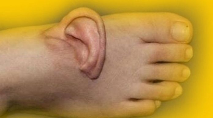 Benzeriz bir olay: Kulağını 5 ay ayağında taşıdı