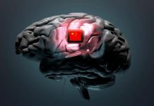 Dünyada ilk: Çin felçli hastalar için beyin implantına ticari onay verdi