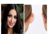 Derya YAĞMUR; Otoplasti: Kendine Güvenin Sessiz Dokunuşu