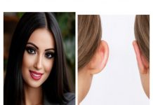 Derya YAĞMUR; Otoplasti: Kendine Güvenin Sessiz Dokunuşu