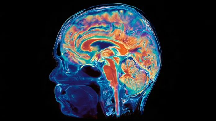 brain-scan-mri