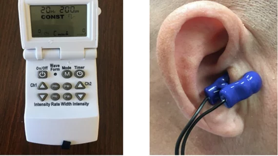 ear-clip_device_to_treat_postural_tachycardia_syndrome_aha_.jpg